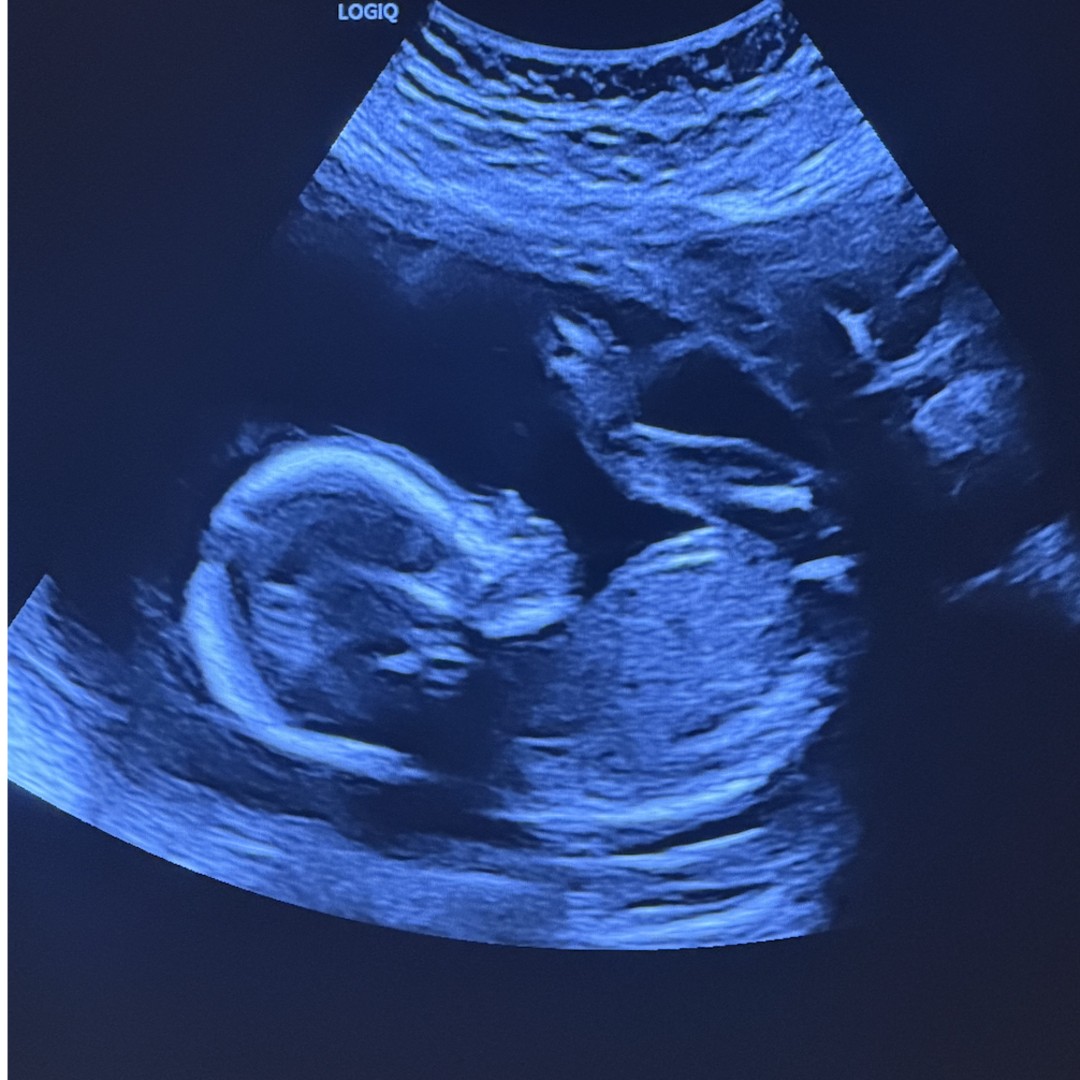 Photo shared by Hannah for their Babylist baby registry.