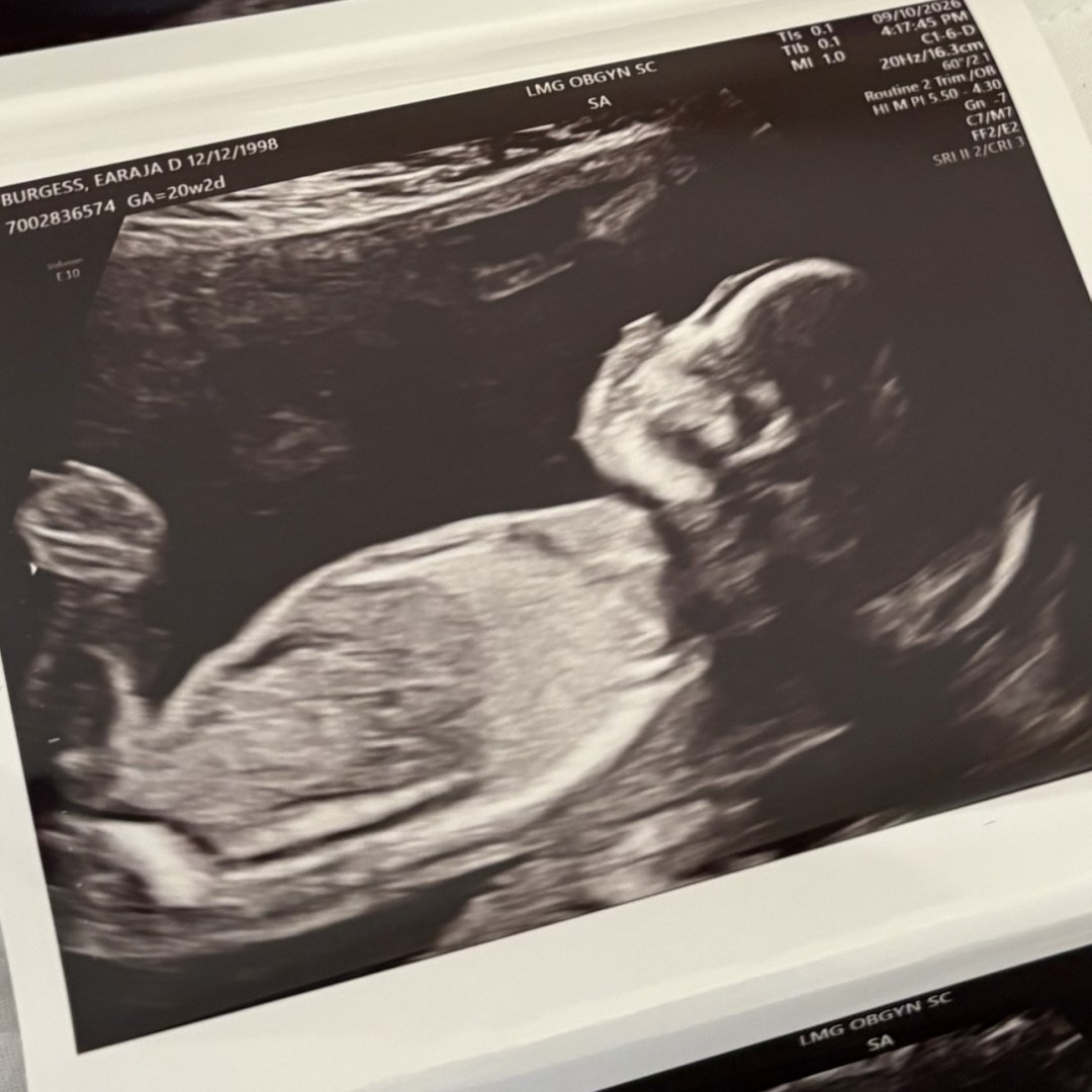 Photo shared by Earaja for their Babylist baby registry.