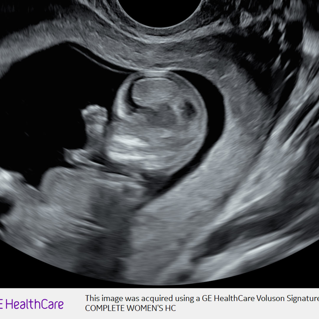 Photo shared by Claire for their Babylist baby registry.