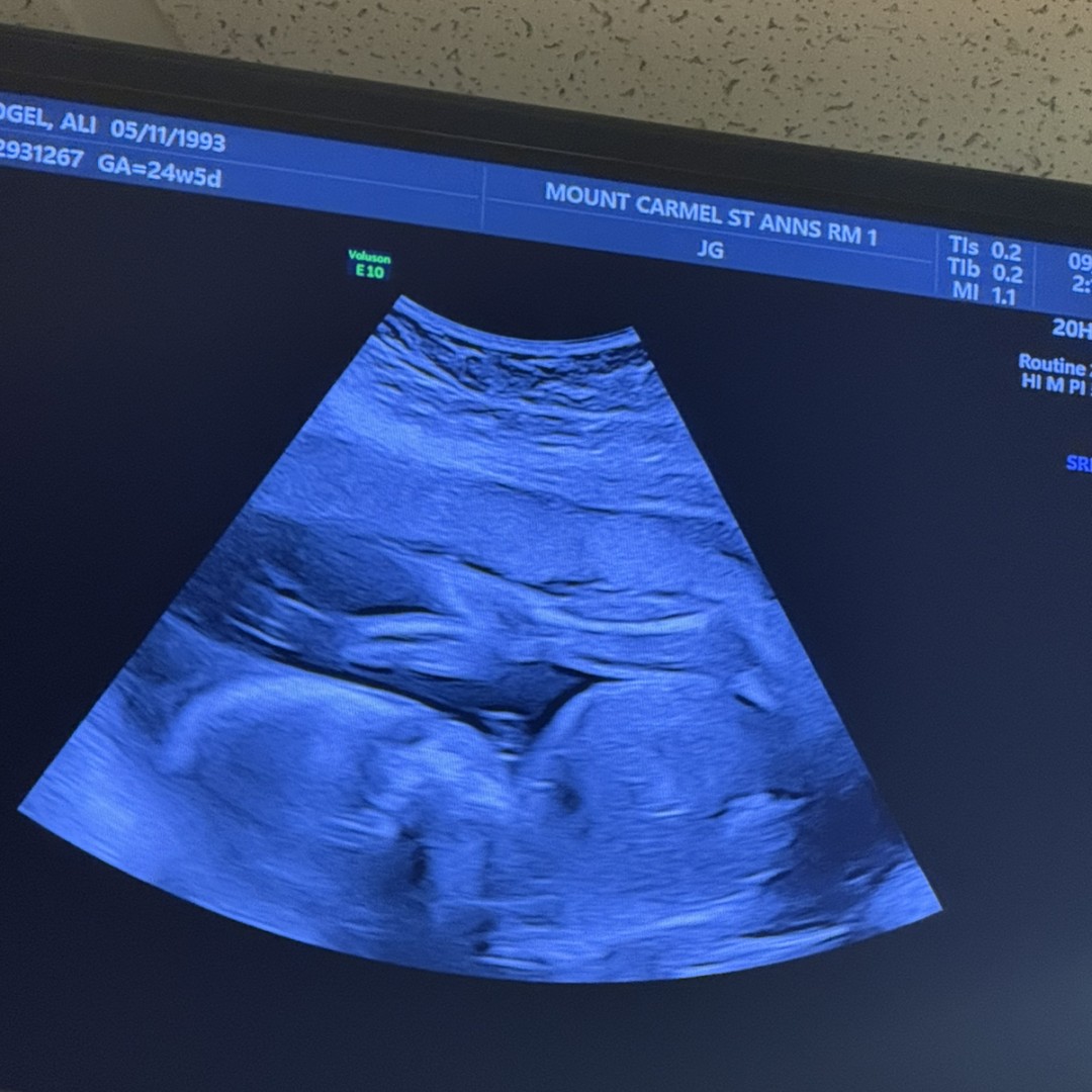Photo shared by Ali for their Babylist baby registry.