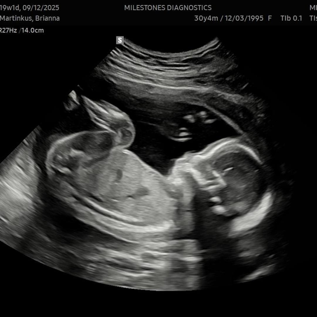 Photo shared by Brianna for their Babylist baby registry.