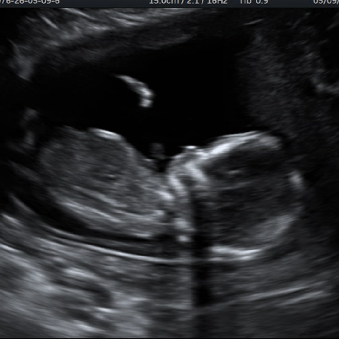 Photo shared by Danielle for their Babylist baby registry.