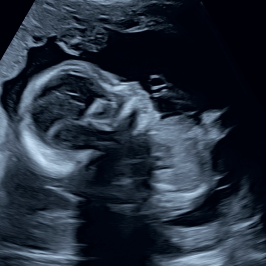 Photo shared by Cailynn for their Babylist baby registry.