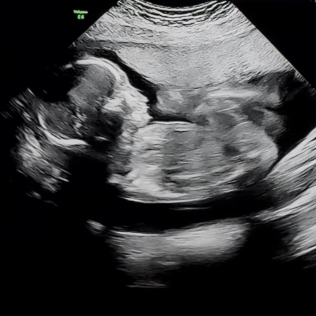 Photo shared by Zuleyma for their Babylist baby registry.