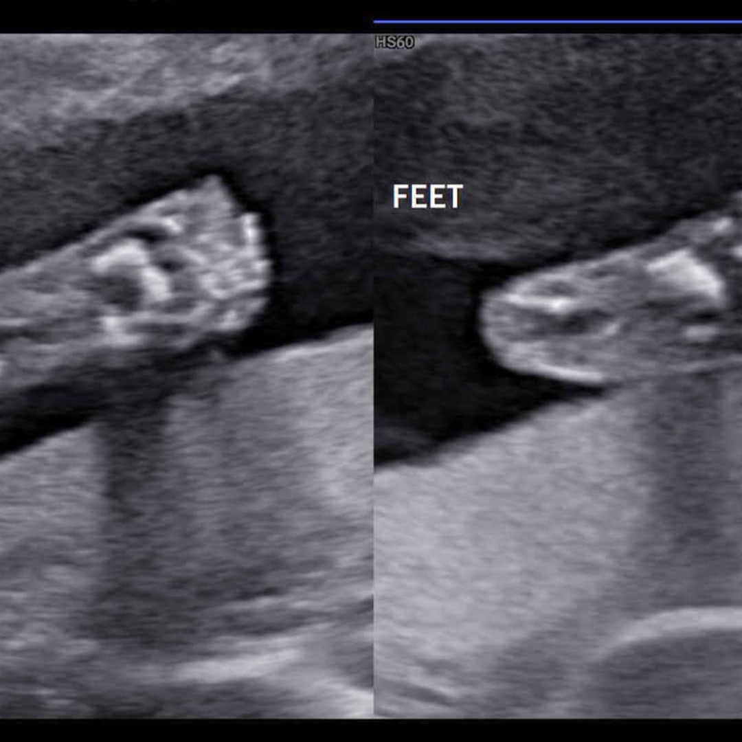 Photo shared by April for their Babylist baby registry.