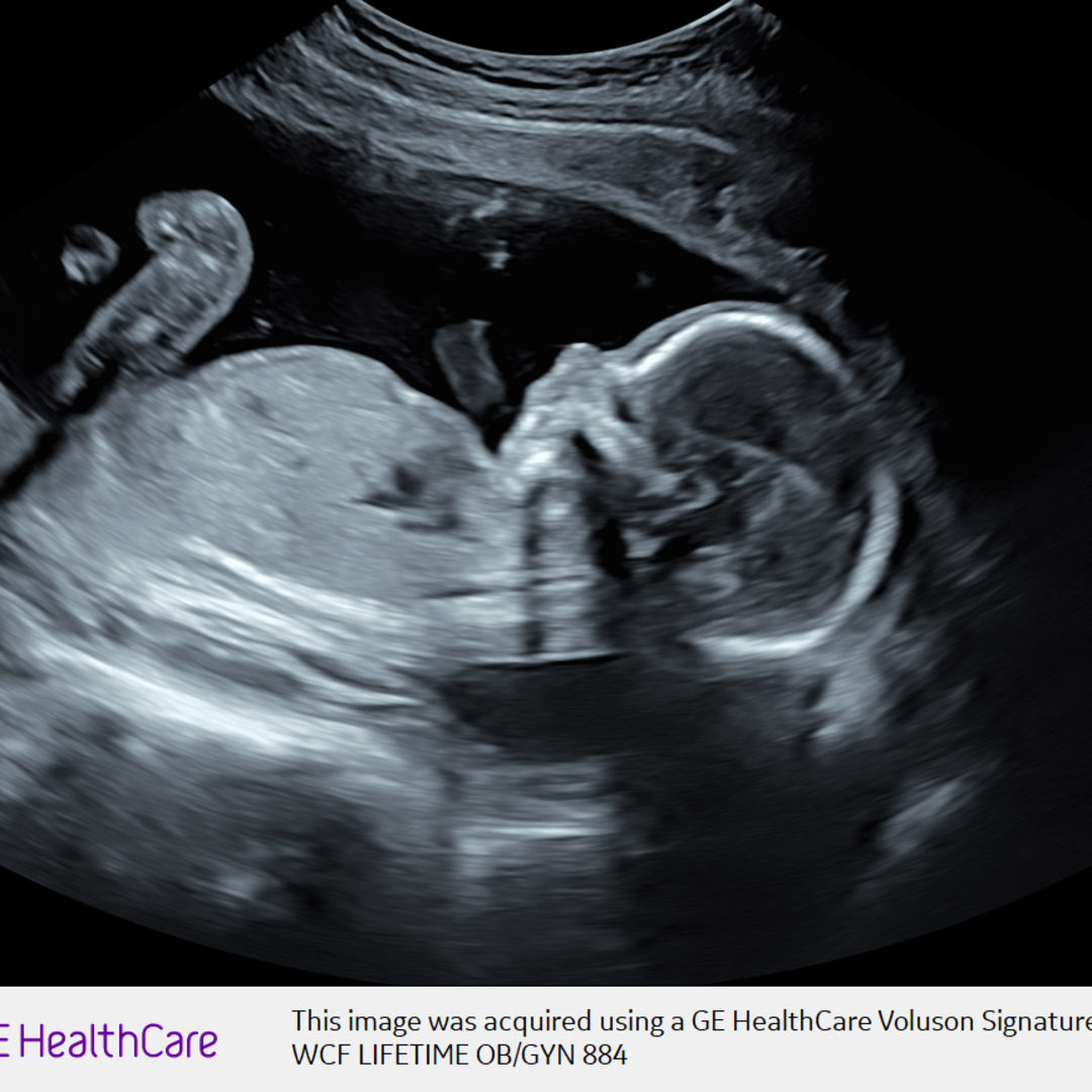 Photo shared by Kambrie for their Babylist baby registry.