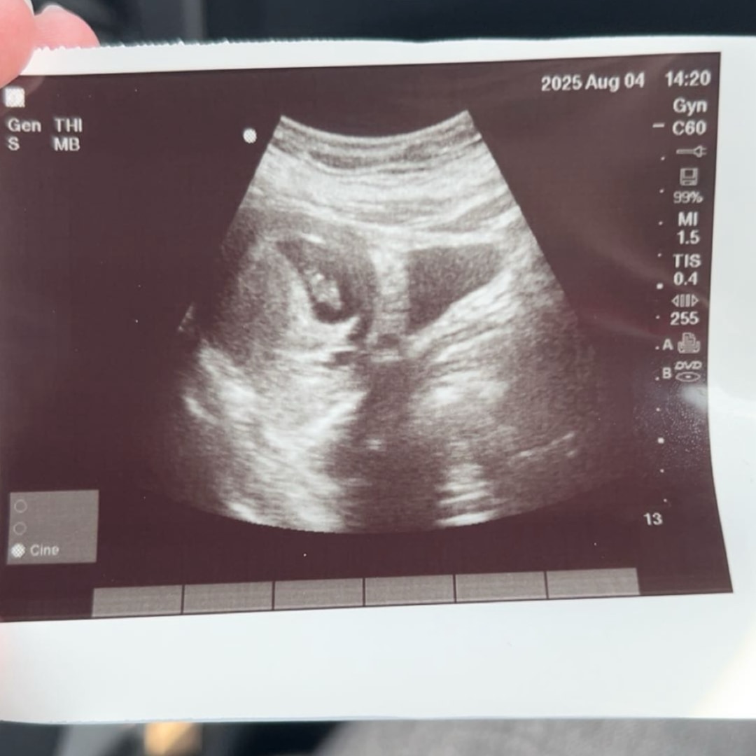 Photo shared by Karin for their Babylist baby registry.