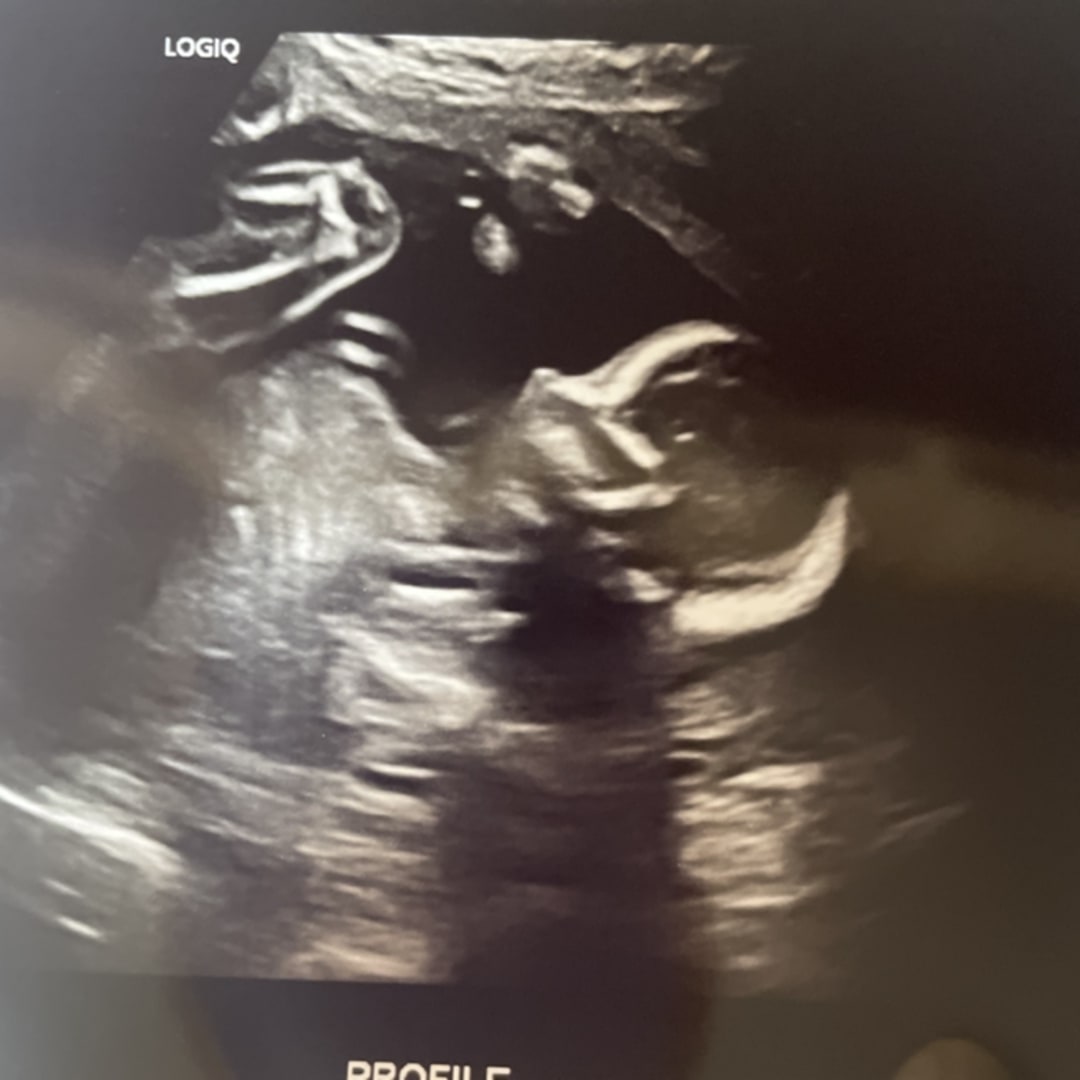 Photo shared by Kelly for their Babylist baby registry.