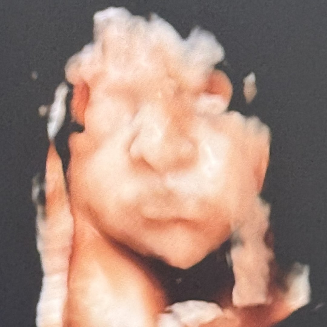 Photo shared by Sophia for their Babylist baby registry.