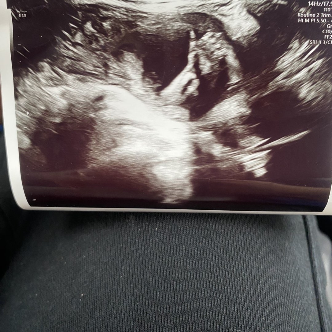 Photo shared by Amaurie for their Babylist baby registry.