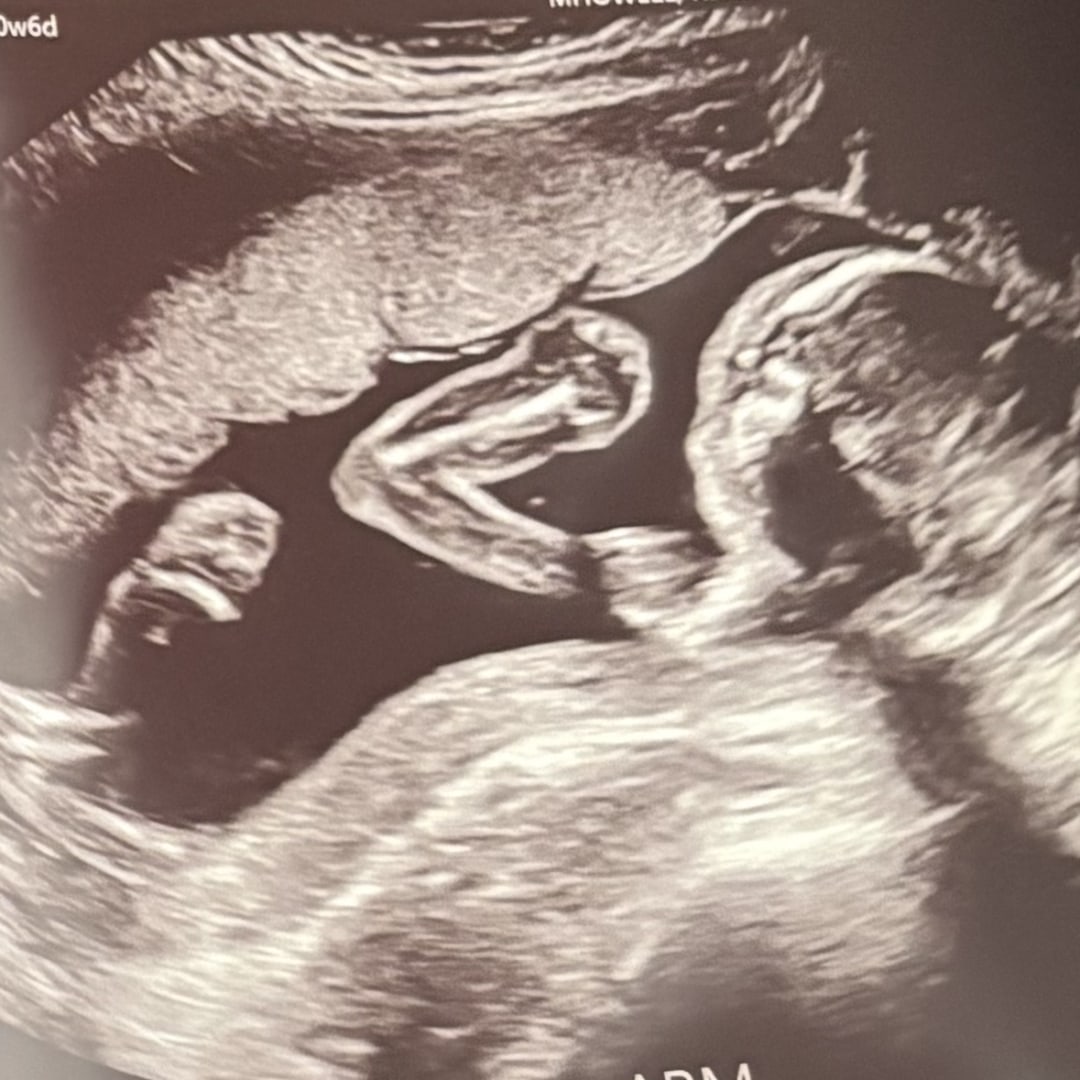 Photo shared by Hallie for their Babylist baby registry.