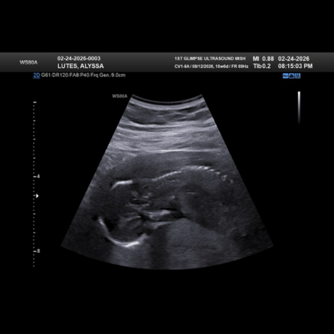 Photo shared by Alyssa for their Babylist baby registry.