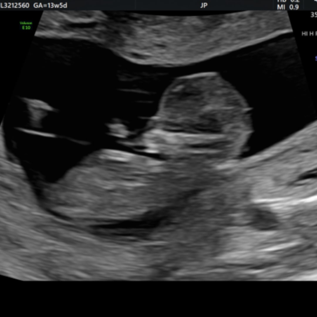 Photo shared by Mersadies for their Babylist baby registry.