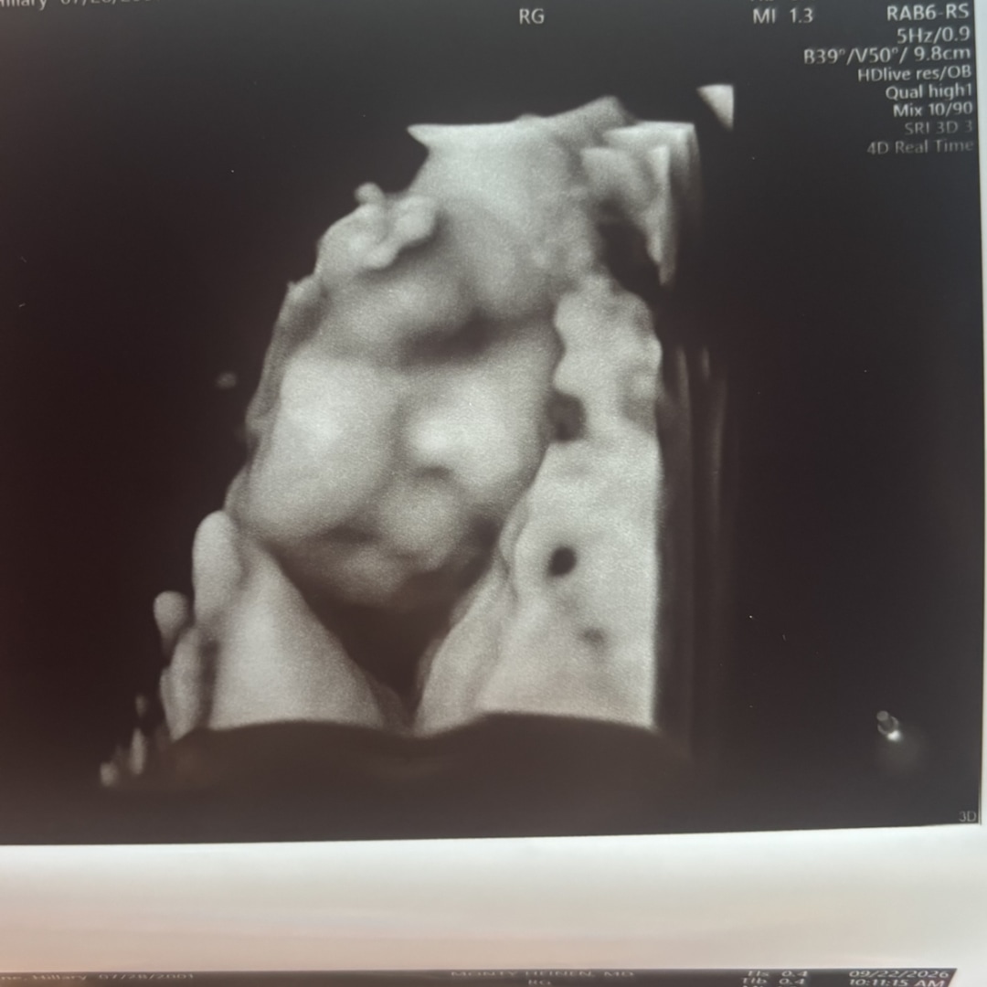Photo shared by Hillary for their Babylist baby registry.
