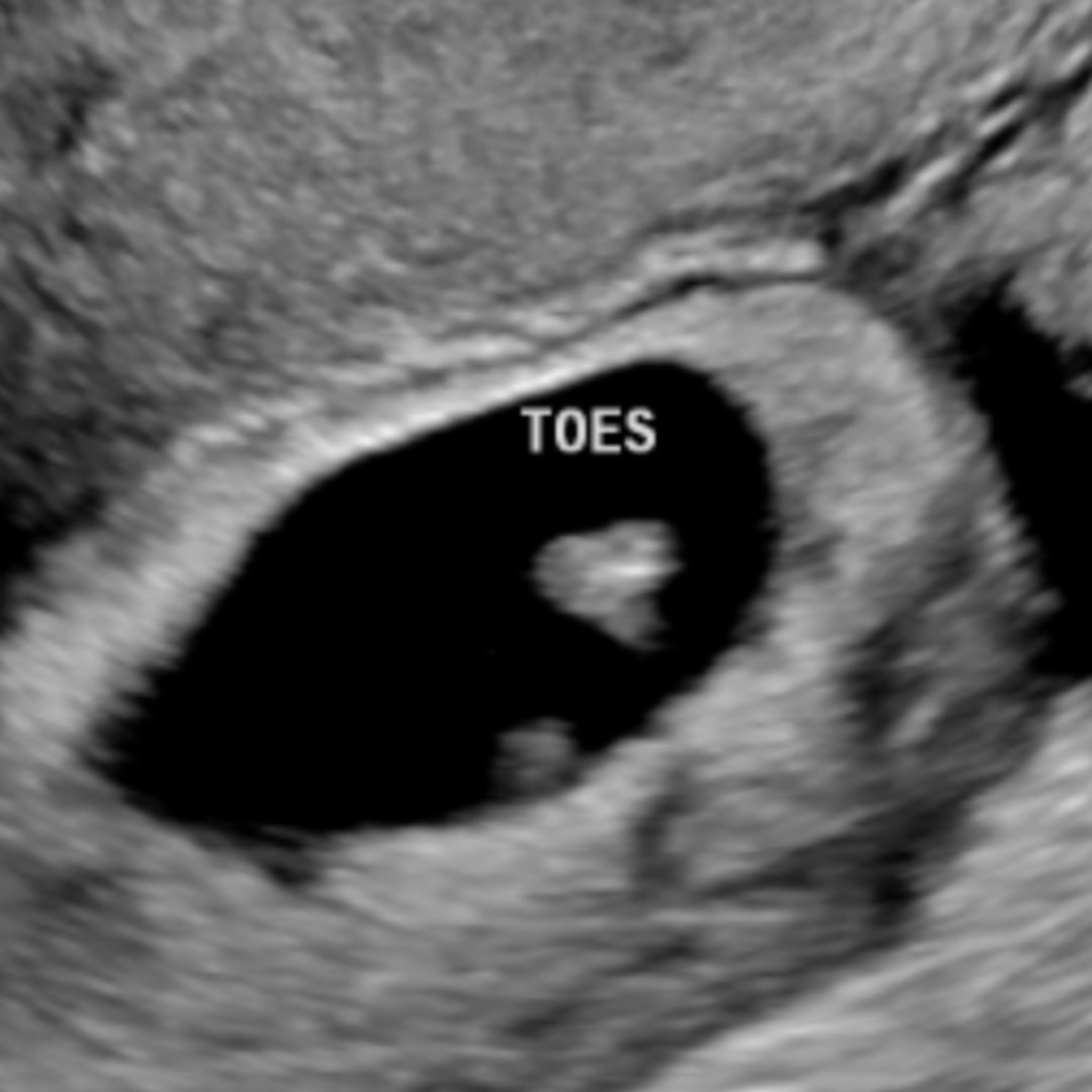 Photo shared by Adia for their Babylist baby registry.