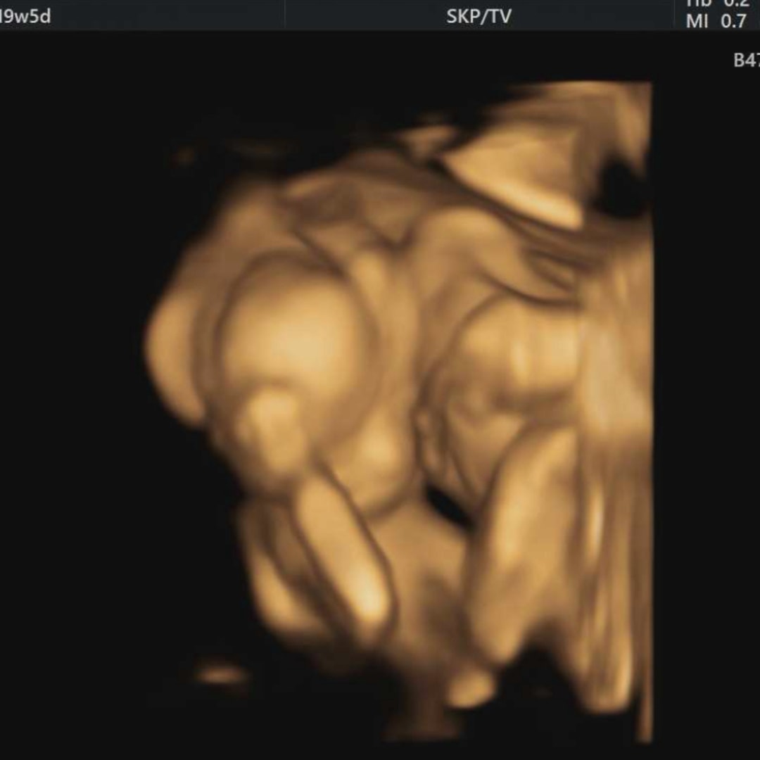 Photo shared by Dani for their Babylist baby registry.