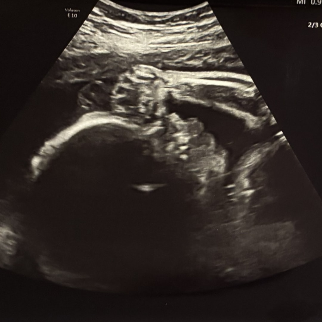 Photo shared by Destiny for their Babylist baby registry.