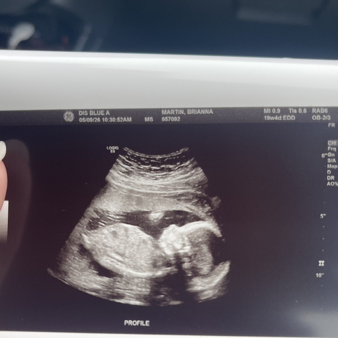 Photo shared by Brianna for their Babylist baby registry.