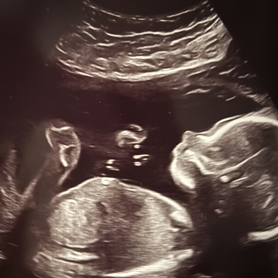 Photo shared by Shelby for their Babylist baby registry.