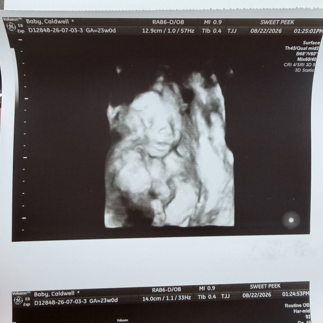 Photo shared by Maddie for their Babylist baby registry.