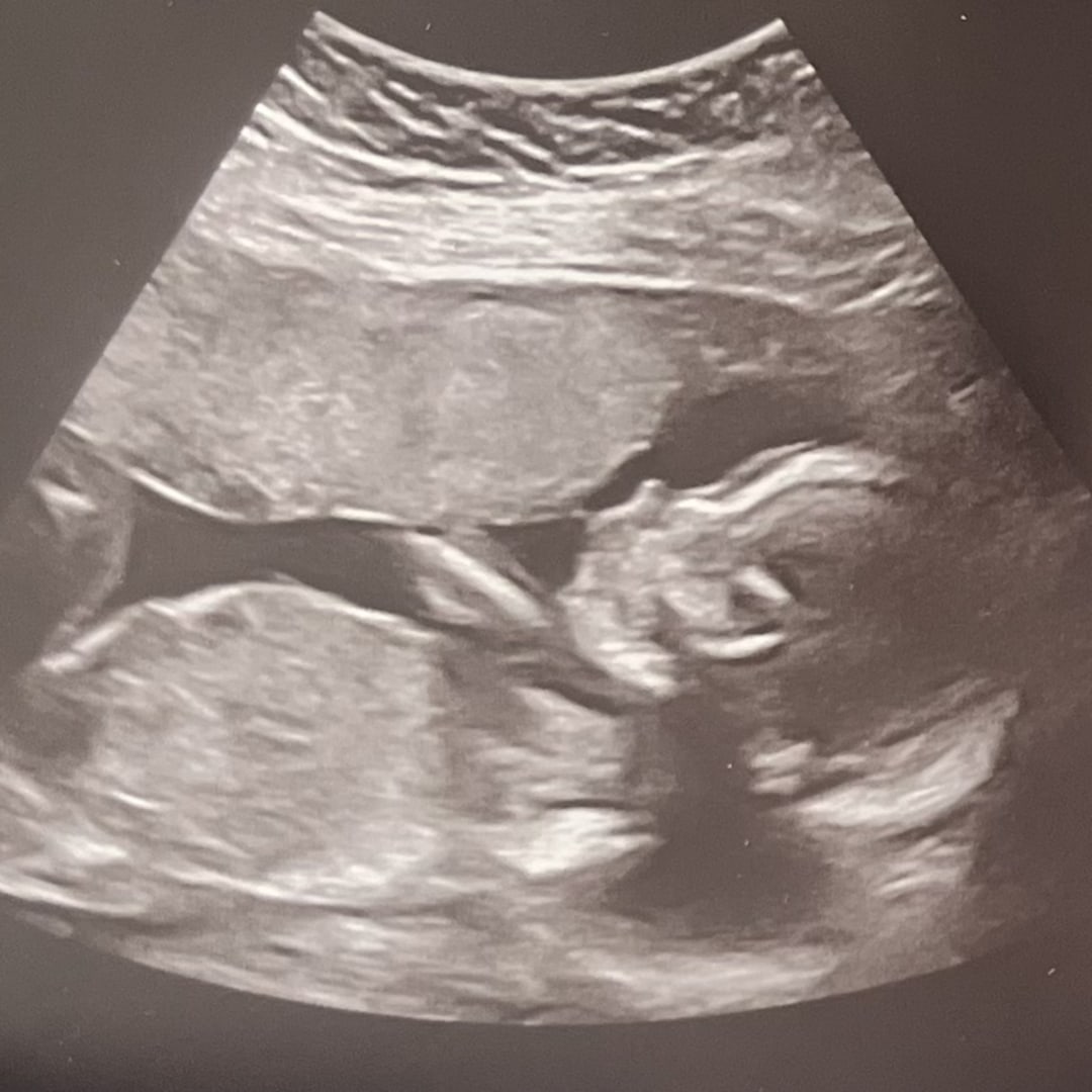 Photo shared by Aubrey for their Babylist baby registry.