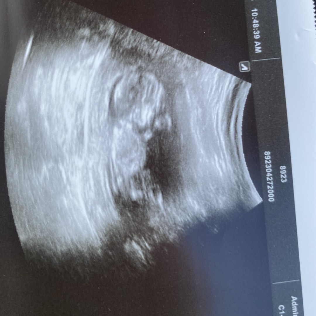 Photo shared by Jamie lee for their Babylist baby registry.