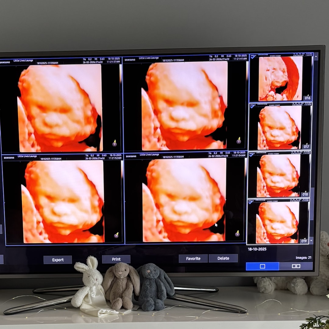 Photo shared by Dakota for their Babylist baby registry.