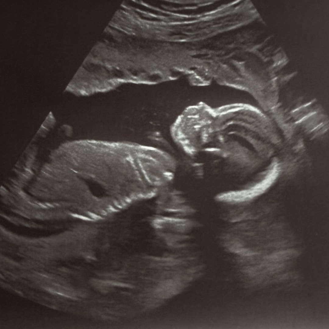 Photo shared by Erika for their Babylist baby registry.