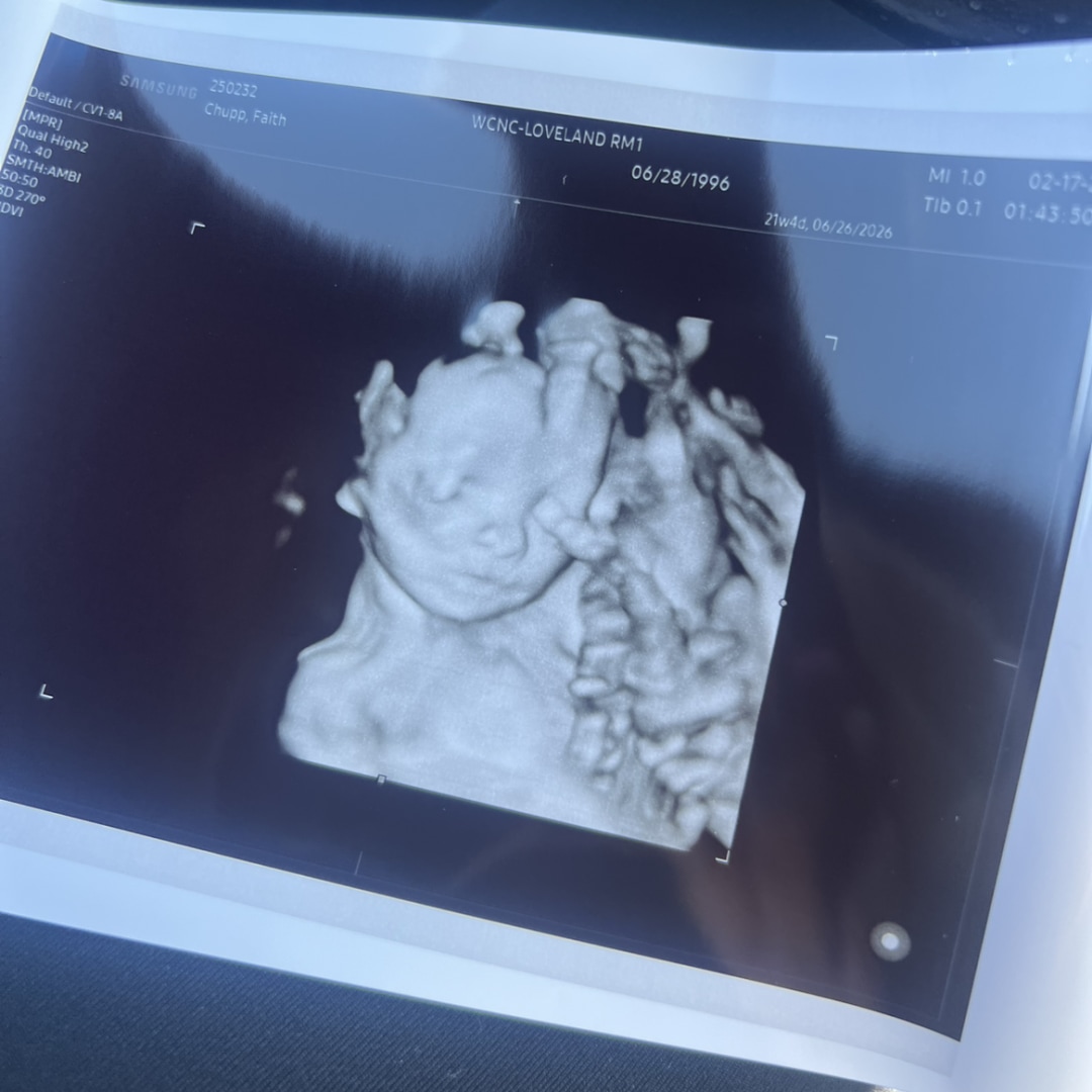 Photo shared by Abby for their Babylist baby registry.