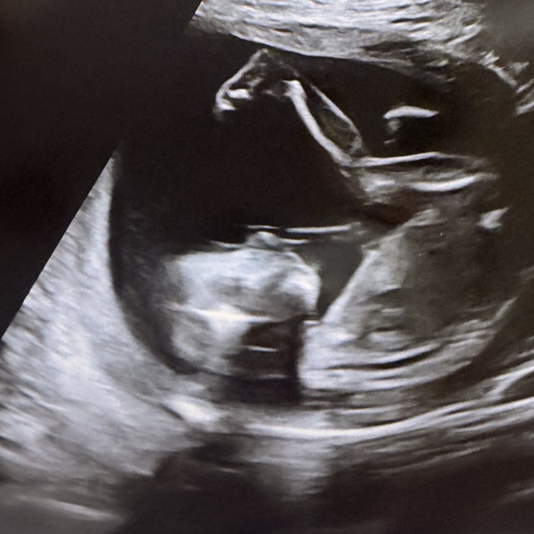 Photo shared by Emily for their Babylist baby registry.