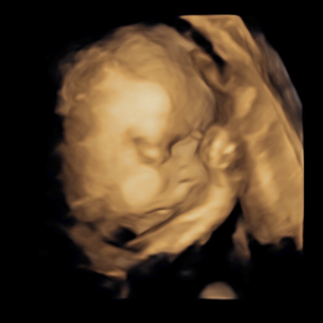 Photo shared by Aubrey for their Babylist baby registry.