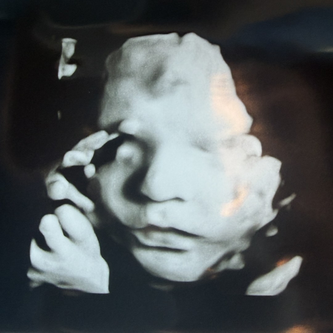 Photo shared by Lauren for their Babylist baby registry.