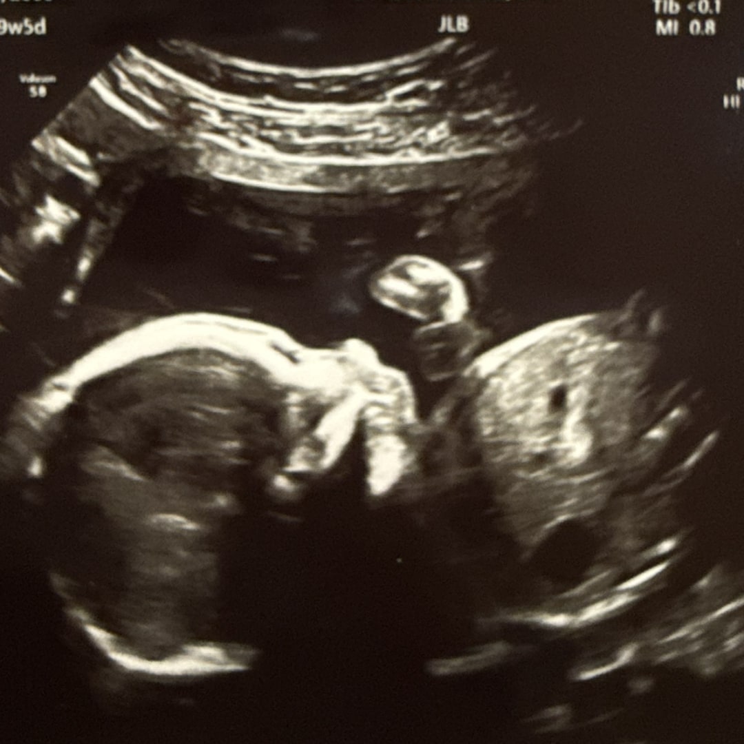 Photo shared by Kiley for their Babylist baby registry.