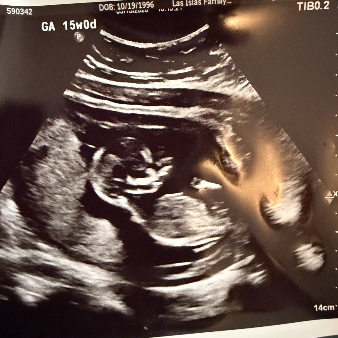 Photo shared by Marissa for their Babylist baby registry.