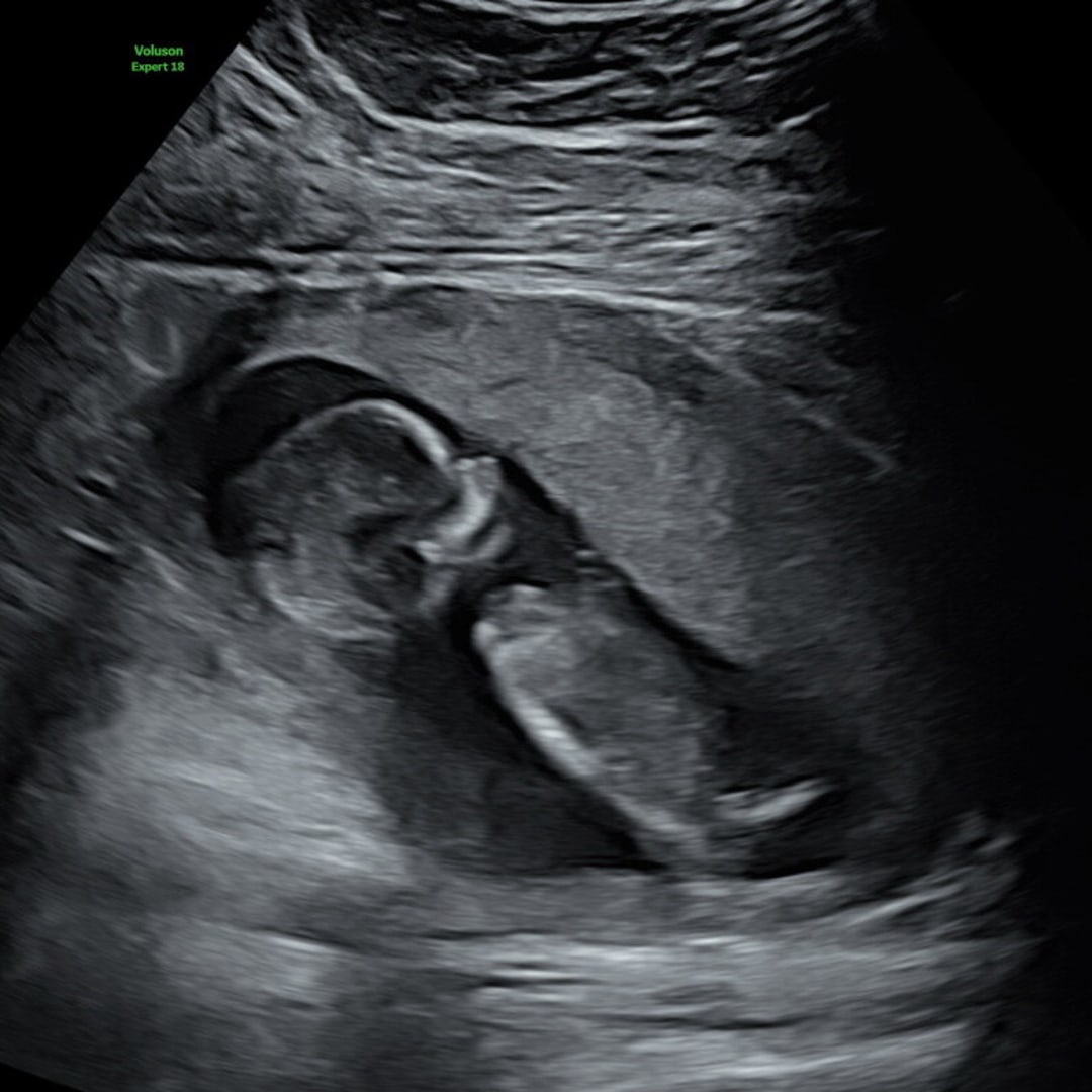 Photo shared by Brianna for their Babylist baby registry.