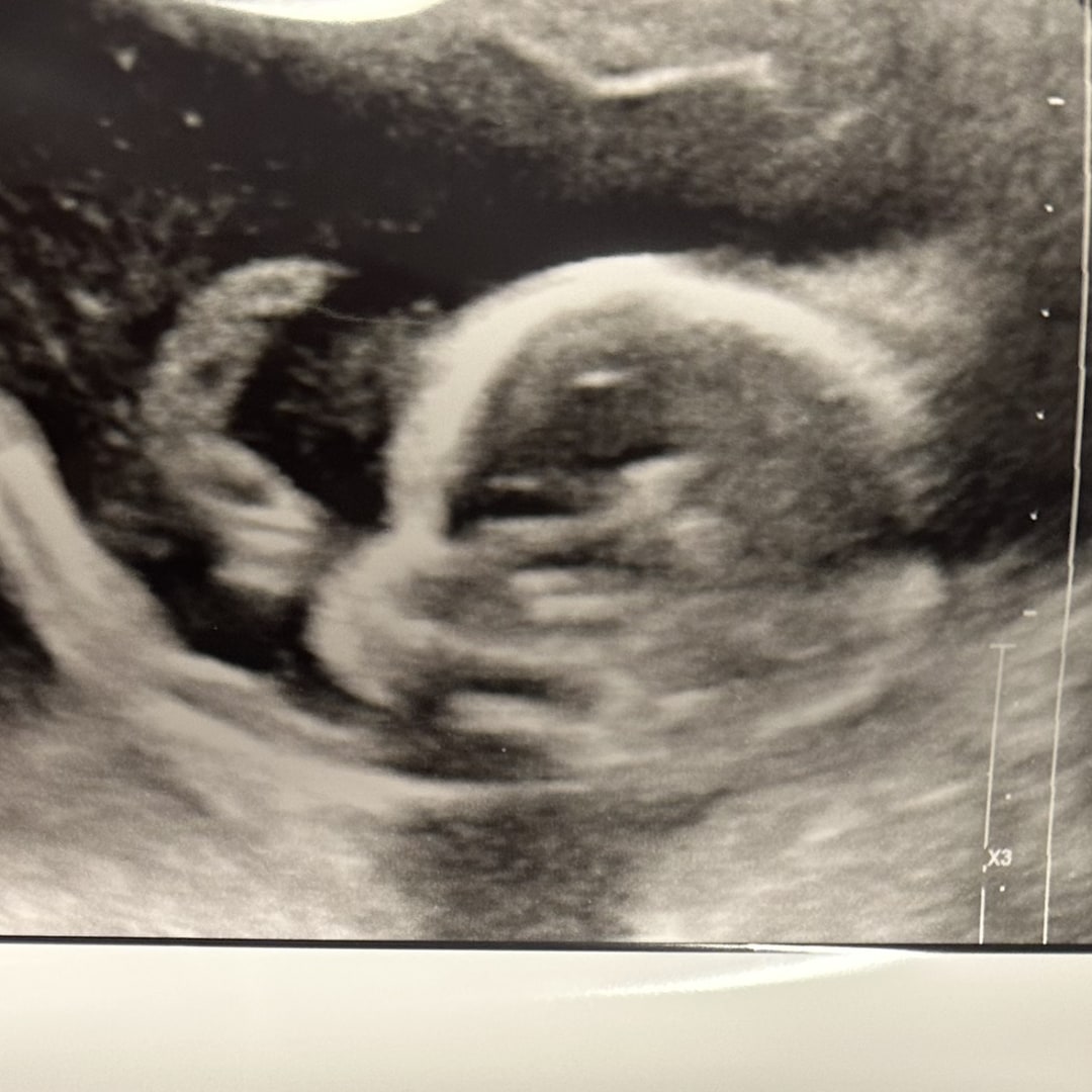 Photo shared by Lucy for their Babylist baby registry.
