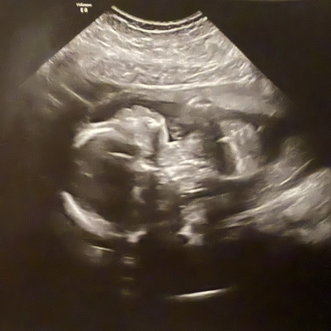 Photo shared by Takaya for their Babylist baby registry.