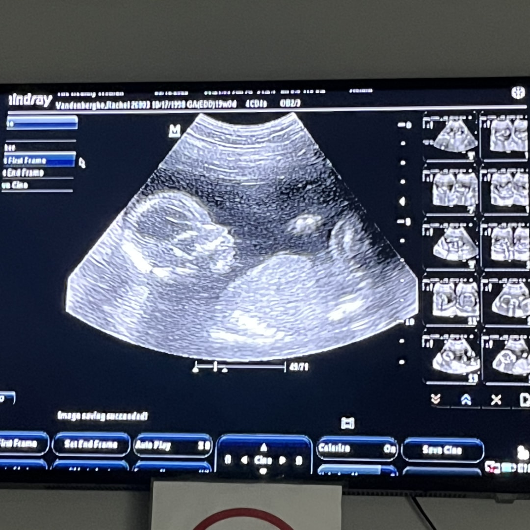 Photo shared by Rachel for their Babylist baby registry.