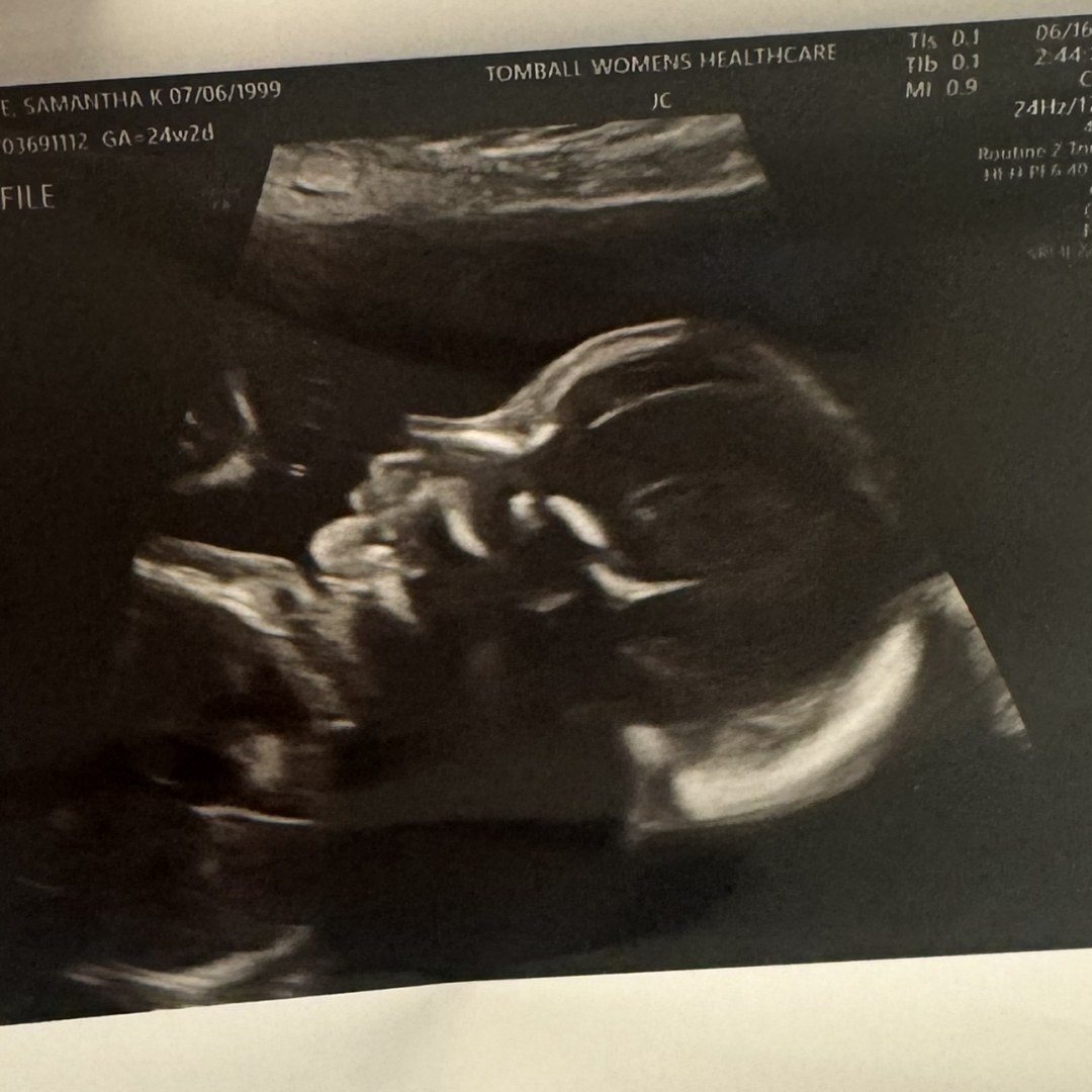 Photo shared by Samantha for their Babylist baby registry.