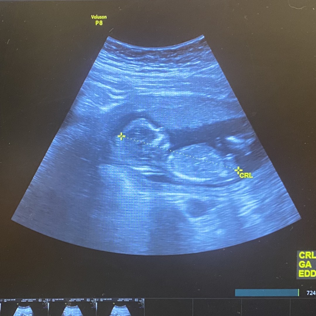 Photo shared by Maryah for their Babylist baby registry.