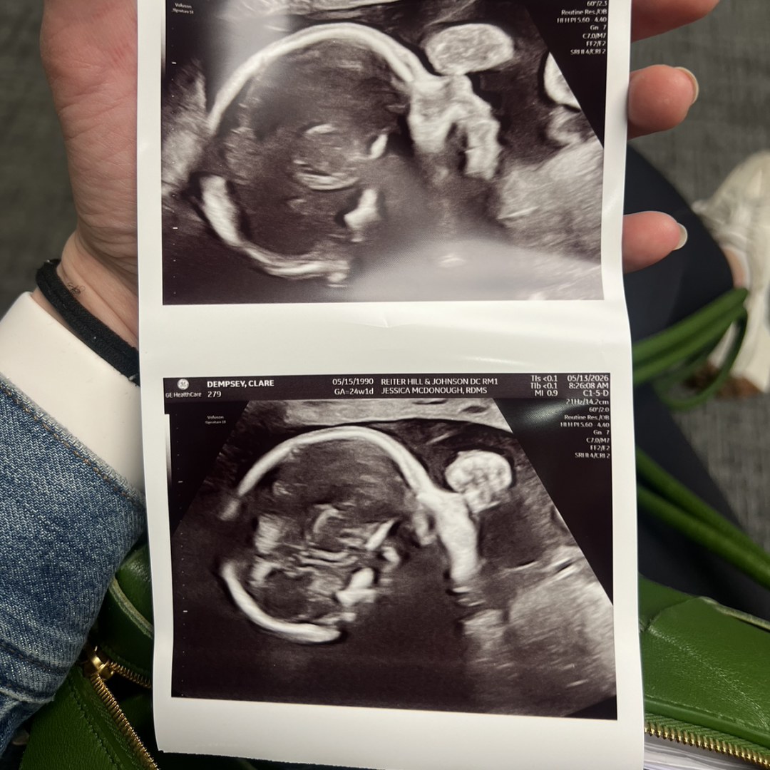 Photo shared by Clare for their Babylist baby registry.