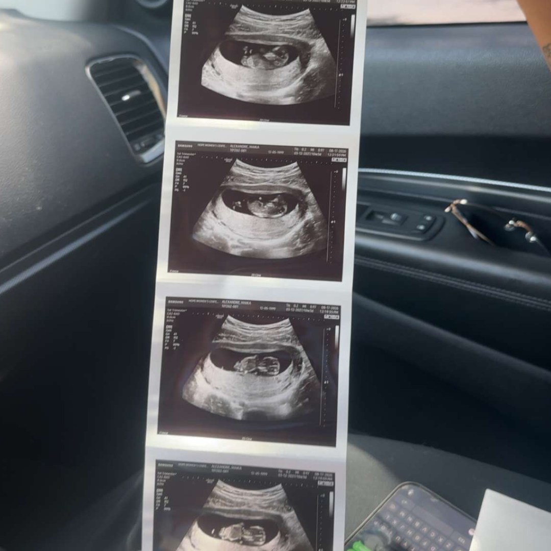 Photo shared by Maika for their Babylist baby registry.