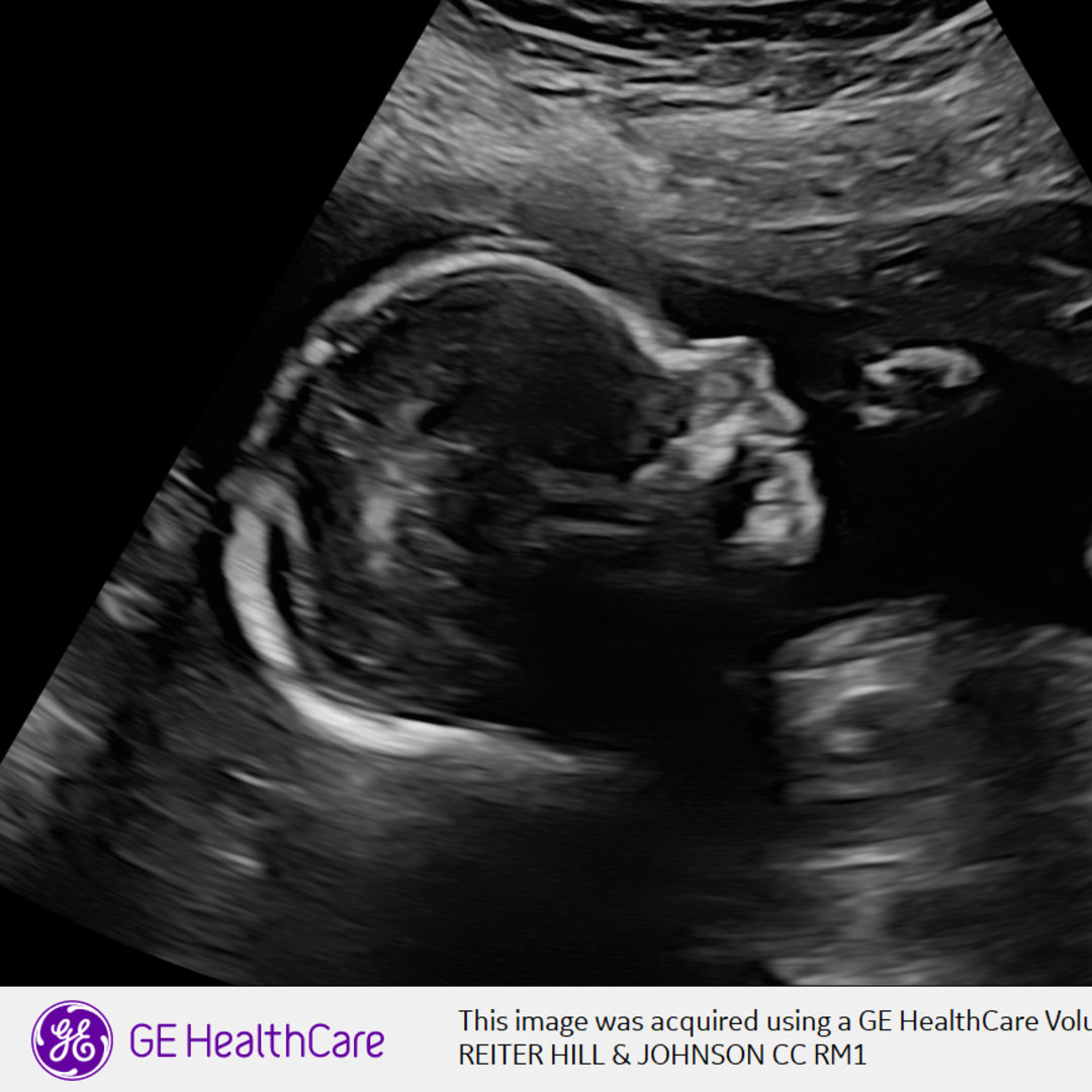 Photo shared by Caitlin for their Babylist baby registry.
