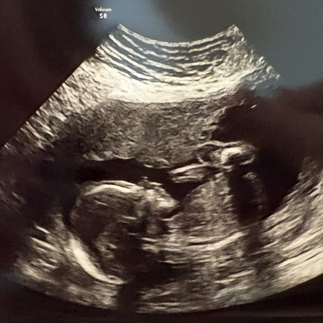 Photo shared by Lexie for their Babylist baby registry.