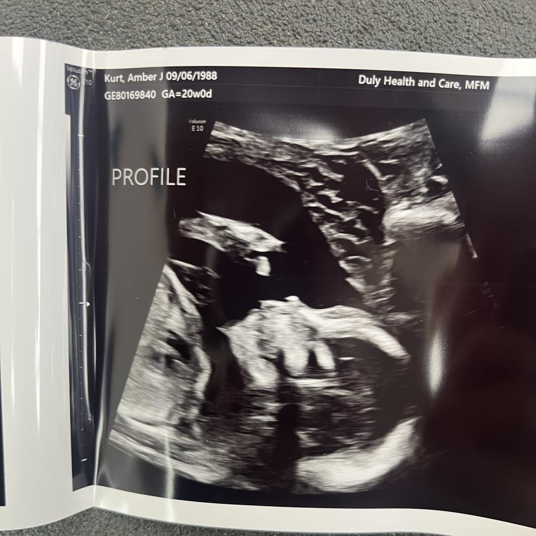 Photo shared by Amber for their Babylist baby registry.