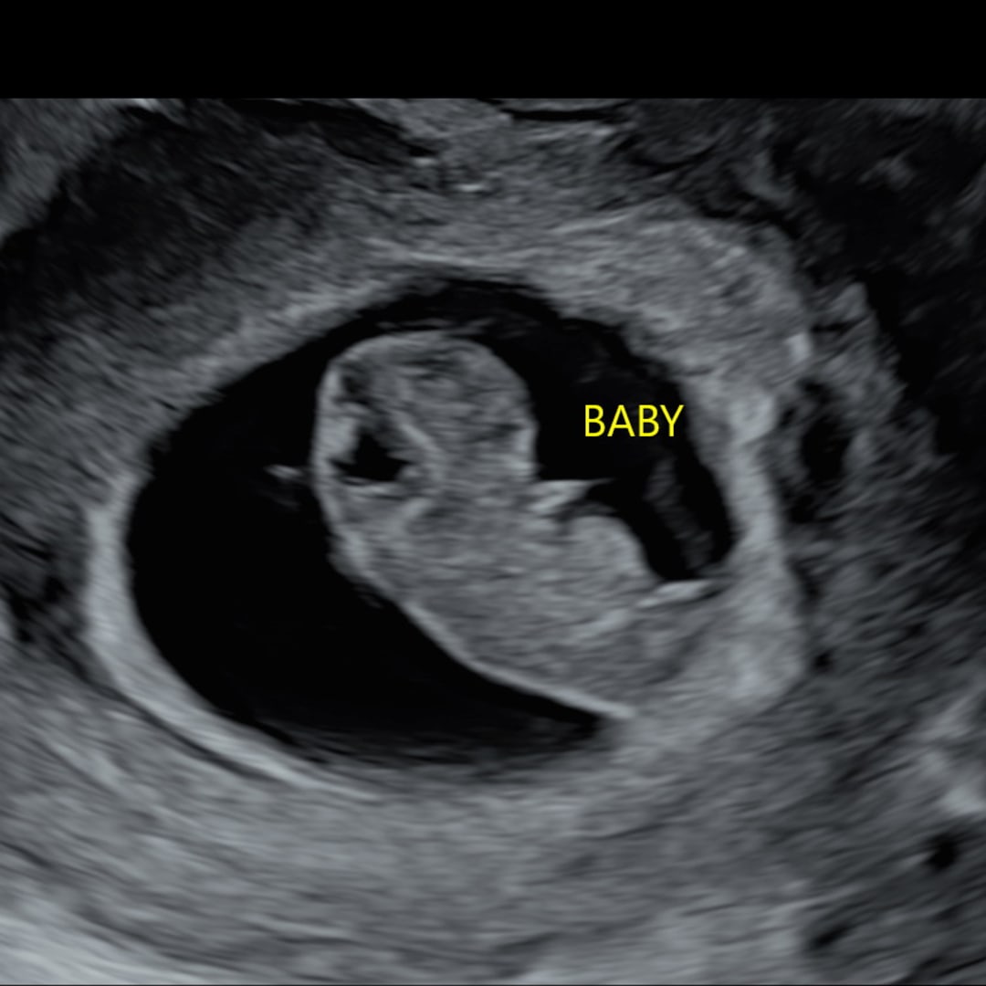 Photo shared by Tabitha for their Babylist baby registry.
