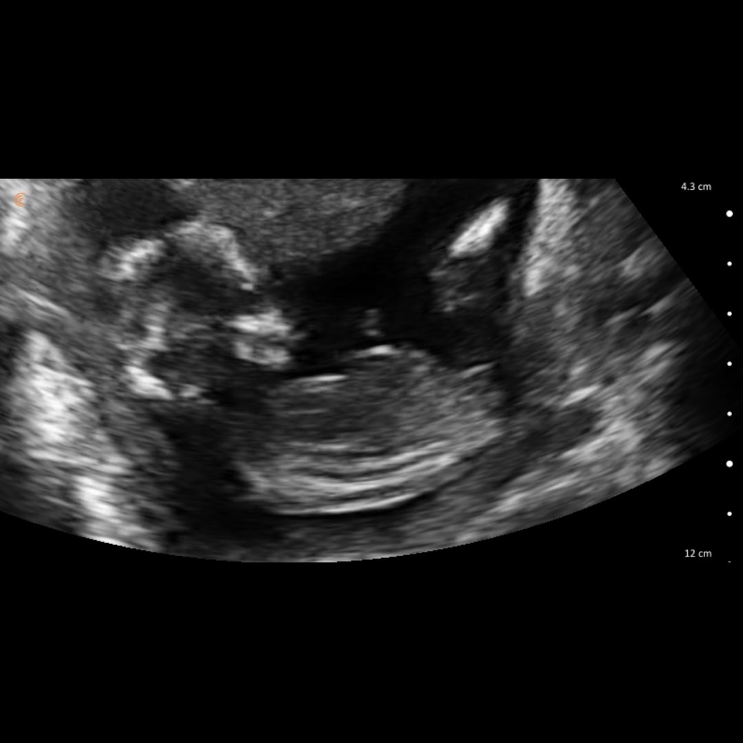 Photo shared by Brittany for their Babylist baby registry.