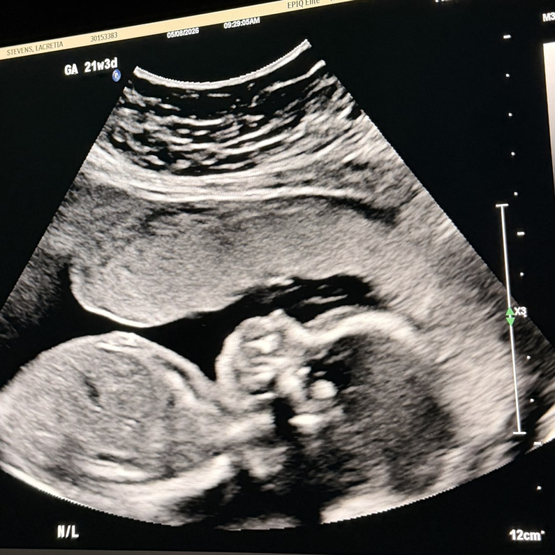 Photo shared by Inez for their Babylist baby registry.