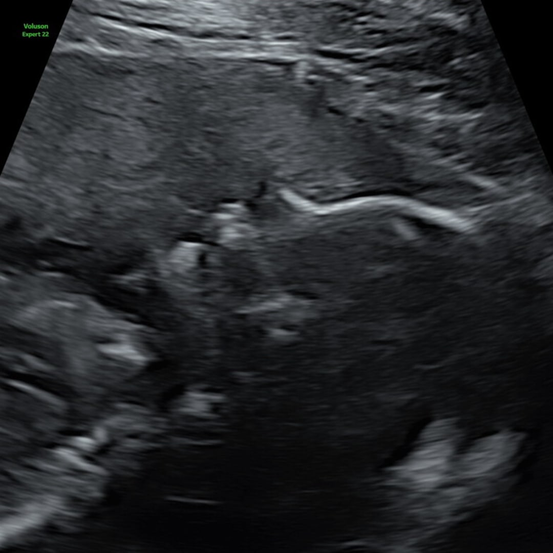 Photo shared by Emily for their Babylist baby registry.