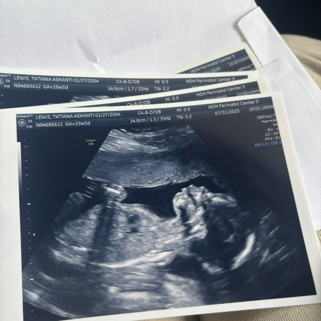Photo shared by Tatiana for their Babylist baby registry.